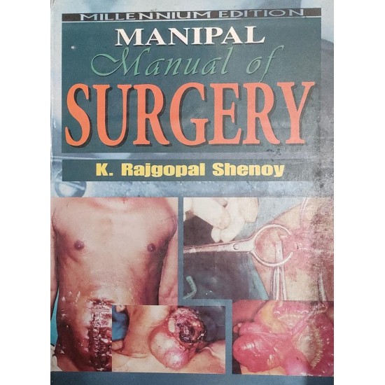 Manual of Surgery millennium edition by K Rajgopal Shenoy 