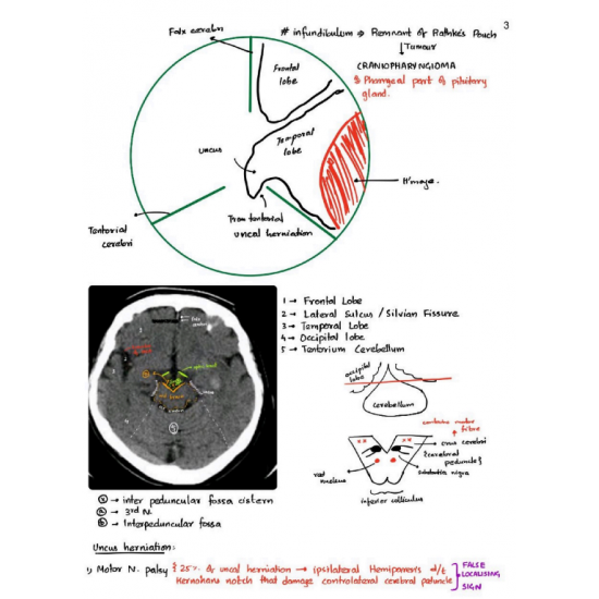 Radiology Handwritten Notes 2023 by Dams 