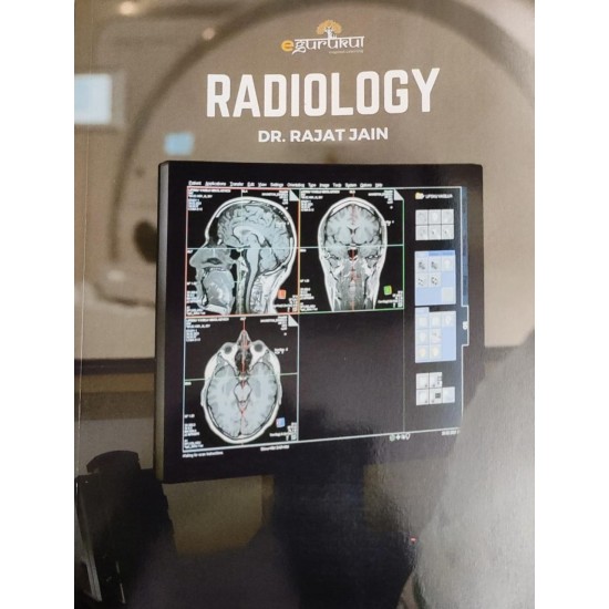 Radiology E gurukul 3.0 Notes by DBMCI