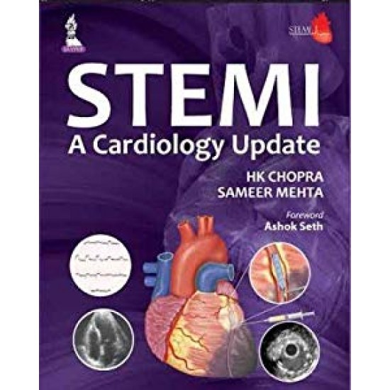 STEMI A CARDIOLOGY UPDATE by HK CHOPRA