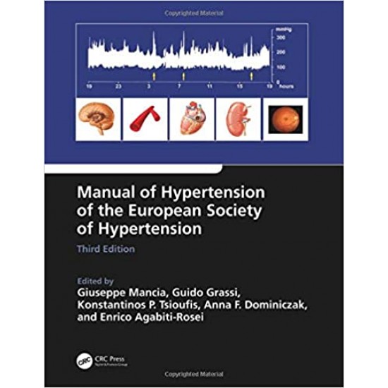 Manual of Hypertension of the European Society of Hypertension, Third Edition by Giuseppe Mancia, Guido Grassi , Konstantinos Tsioufis