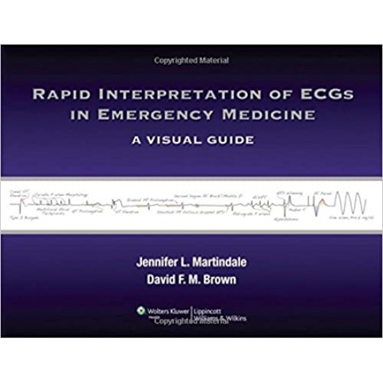 Rapid Interpretation of ECGs in Emergency Medicine  A Visual Guide by Jennifer L. Martindale, David F. M. Brown