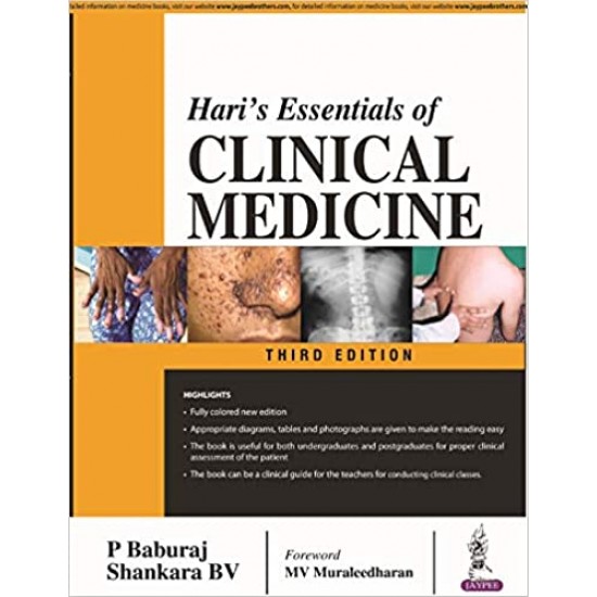 Hari's Essentials Of Clinical Medicine  by P Baburaj Shankara BV