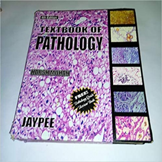 Textbook of pathology  4th edition by harsh mohan