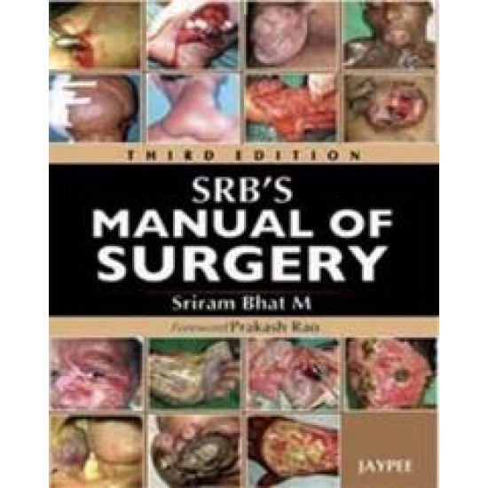 Srbs Manual Of Surgery 3rd Edition by Sriram Bhat