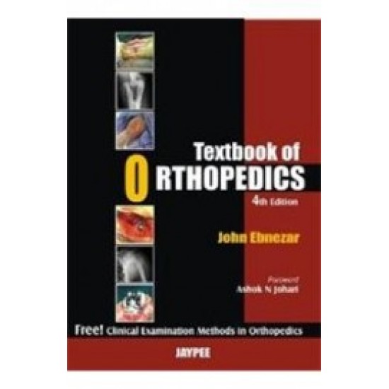 Textbook Of Orthopaedics by John Ebnezar