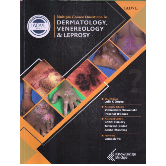 IADVL Multiple Choice Questions In Dermatology, Venereology and Leprosy by Lalit K Gupta