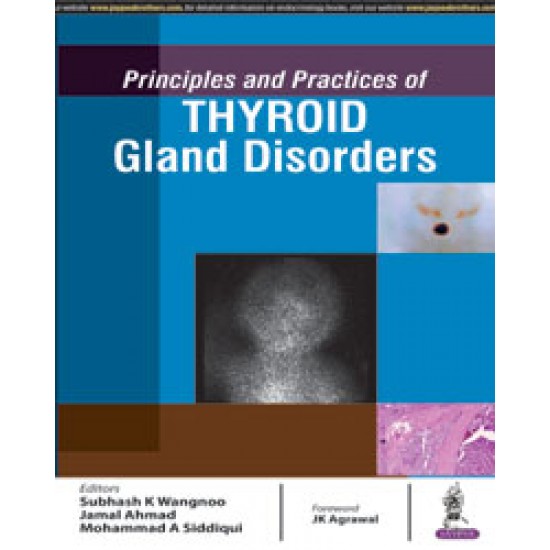 Principles And Practices Of Thyroid Gland Disorders 1st Edition by Subhash K Wangnoo