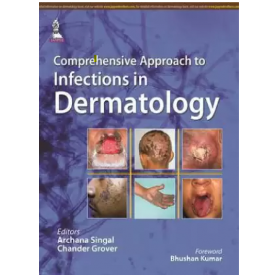 Comprehensive Approach to Infections in Dermatology by Singal Archana