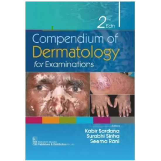 Compendium of Dermatology for Examination 2nd Edition by Kabir Sardana