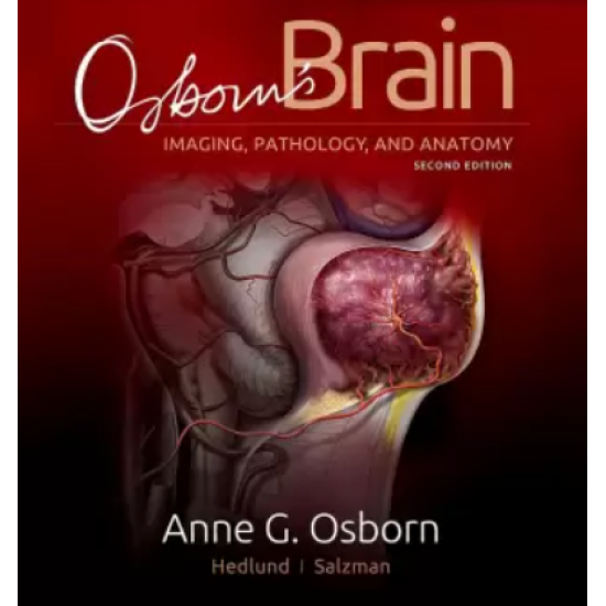 Osbors Brain 2nd Edition by Osborn Anne G. MD, FACR