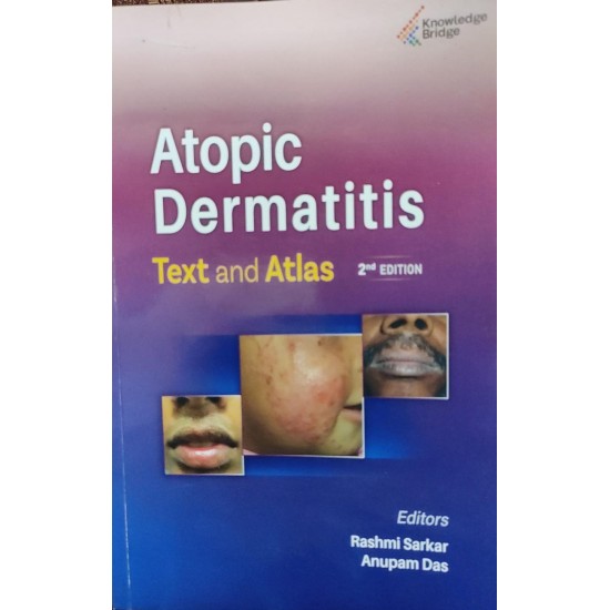 Atopic Dermatitis Text and Atlas 2nd Edition by Rashmi Sarkar