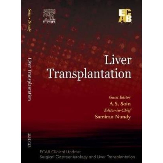 Liver Transplantation by As Soin Ecab Clinical Update Surgical Gastroenterology