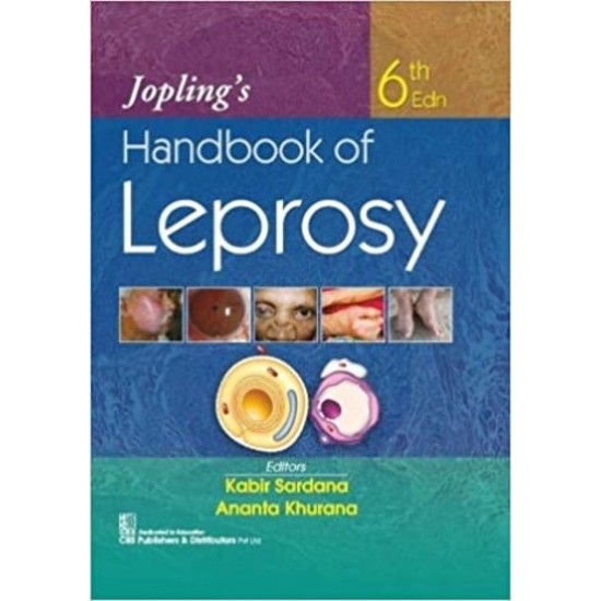 Joplings Handbook Of Leprosy 6th Edition by Kabir Sardana, Ananta Khurana